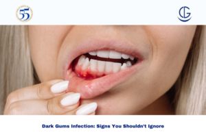 Dark Gums Infection