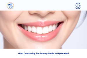 Gum Contouring