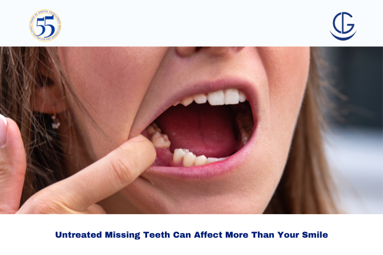 Untreated Missing Teeth