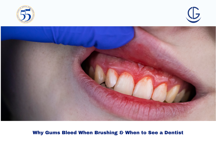 gums bleed when brushing