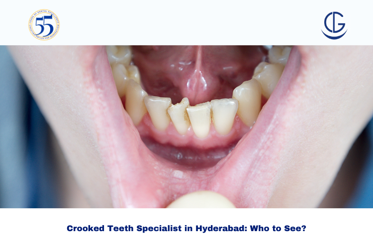 crooked teeth specialist