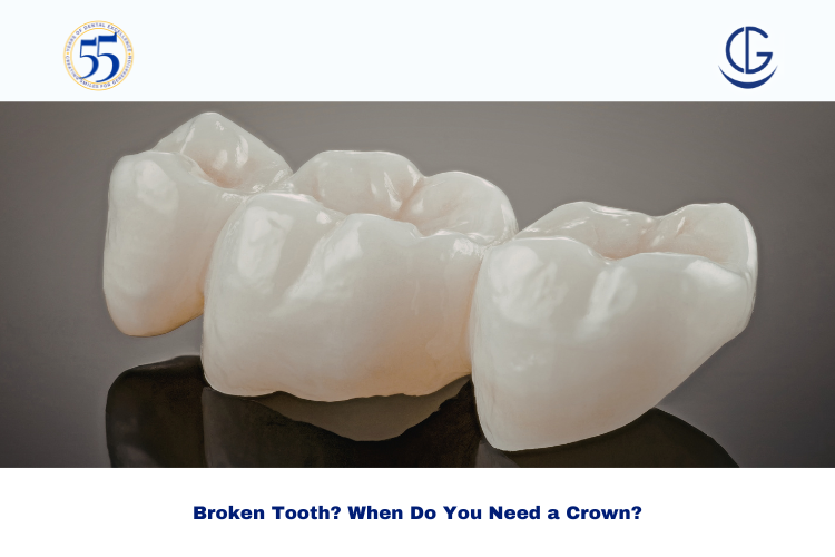 crown for broken tooth