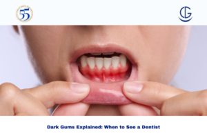 dark gums