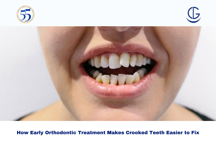 early orthodontic treatment