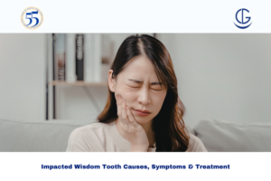 impacted wisdom tooth