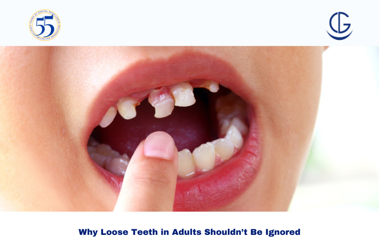 loose teeth in adults