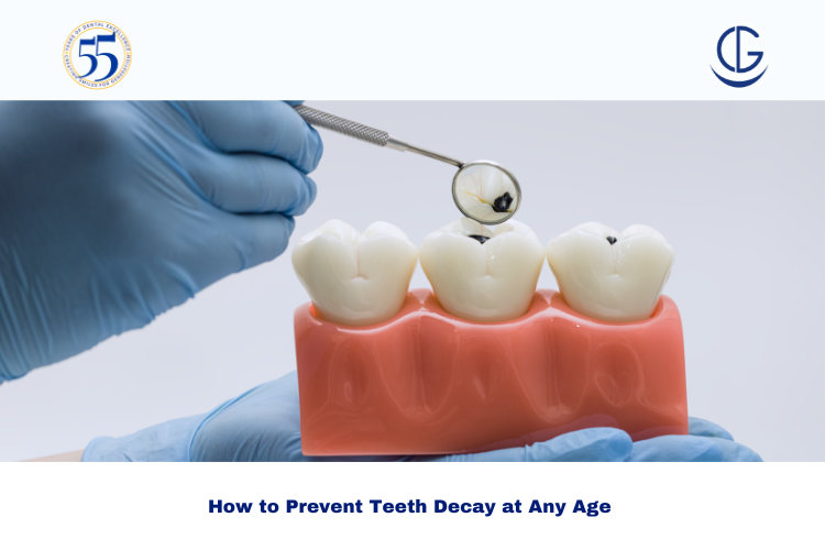 prevent teeth decay
