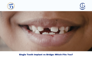 Single Tooth Implant
