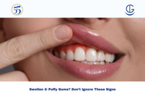 swollen gums