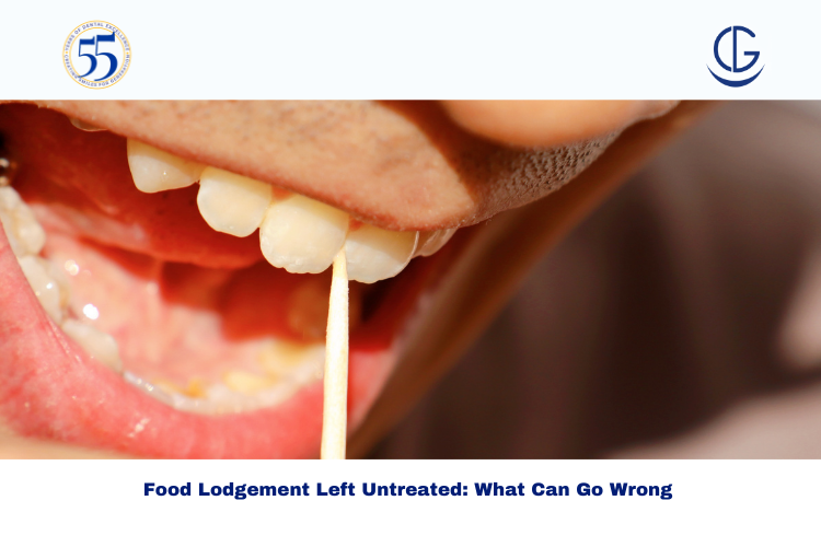 Untreated food lodgement