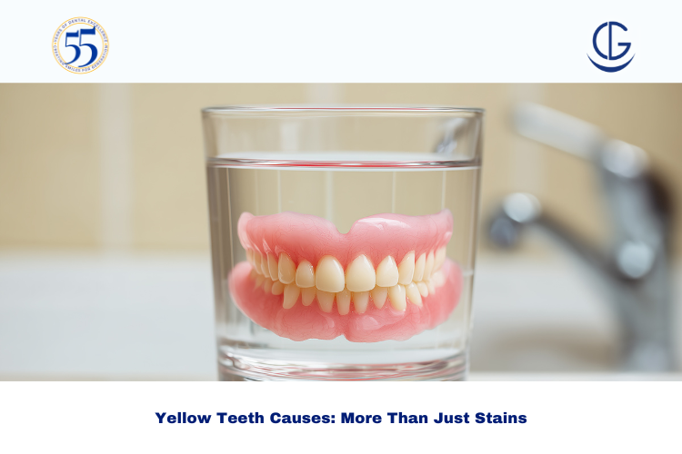 yellow teeth causes