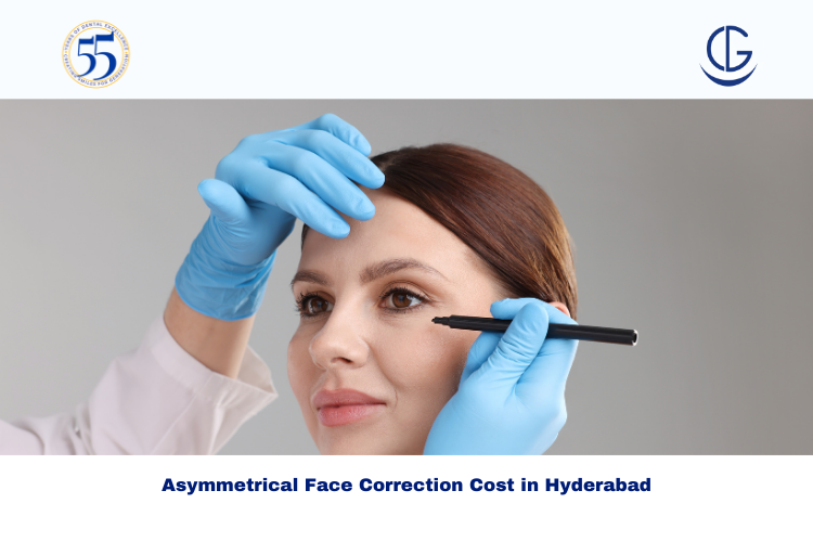 Asymmetrical Face Correction Cost