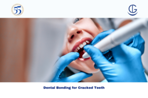 Dental Bonding for Cracked Teeth