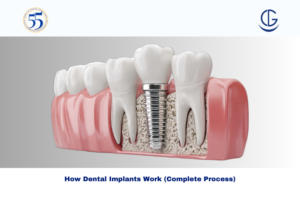 Dental Implant procedure