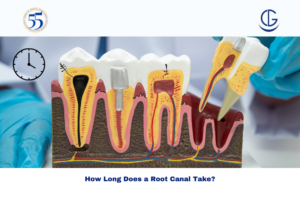 Root canal recovery time