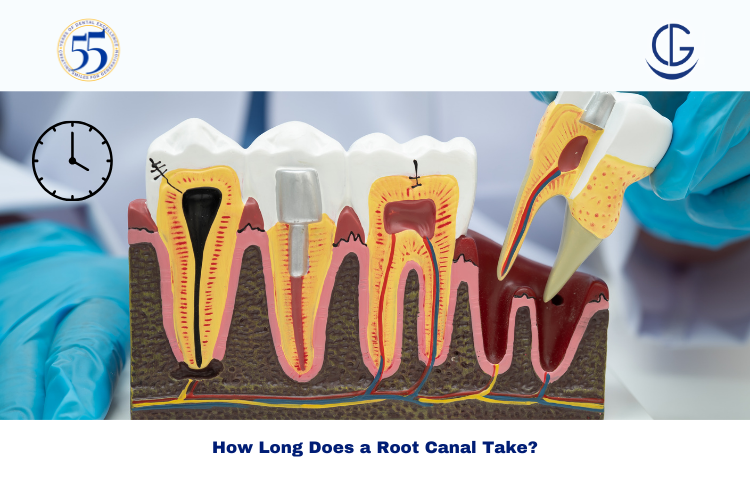 Root canal recovery time