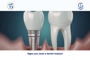 Signs you need a dental implant