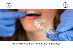 invisible teeth braces