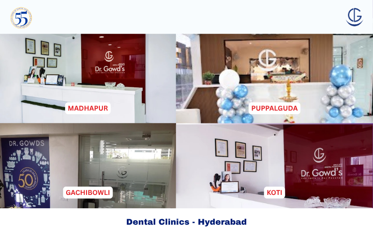 Dental Clinic hyderabad