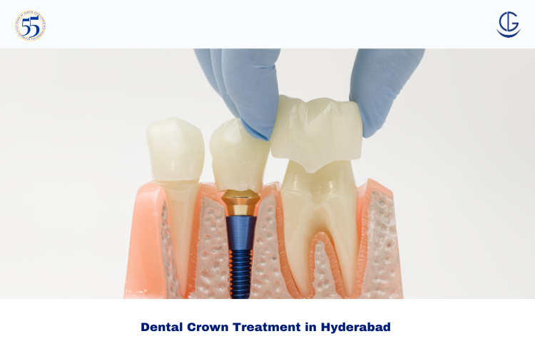 Dental Crown Treatment