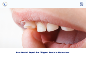 chipped tooth in hyderabad