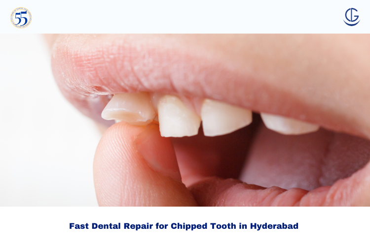chipped tooth in hyderabad