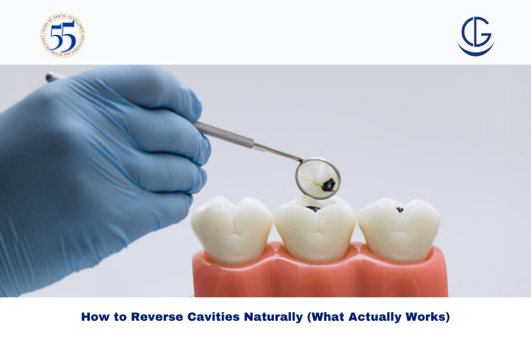 How to Reverse Cavities Naturally