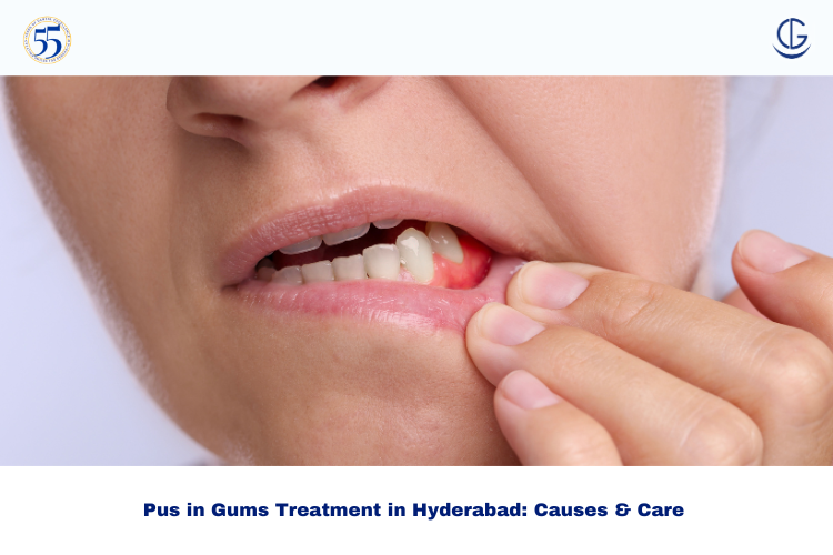 pus in gums treatment