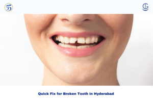 broken tooth in Hyderabad