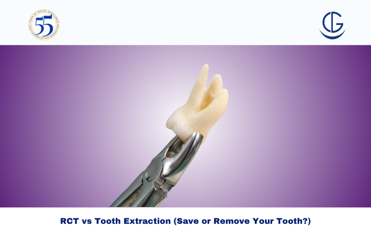 RCT vs Tooth Extraction