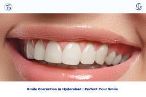 Smile Correction in Hyderabad
