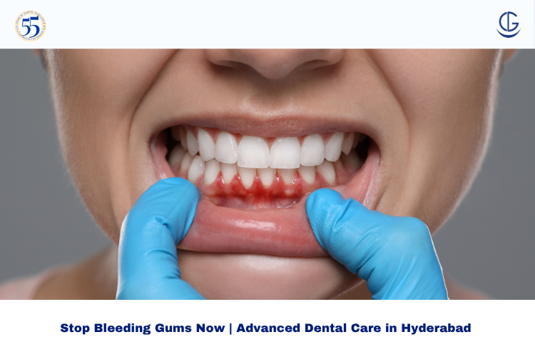 Bleeding gums treatment in Hyderabad