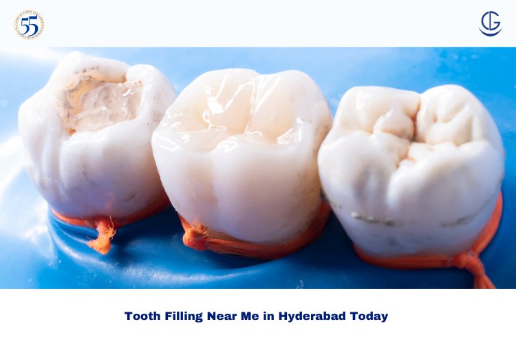 Tooth Filling Near Me