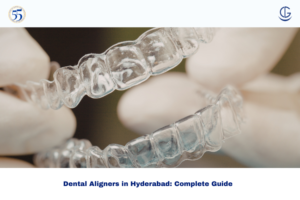 Aligners in Hyderabad