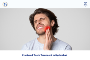 fractured tooth