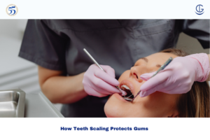 scaling of teeth