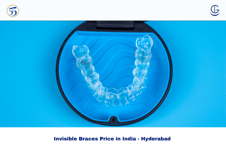 Invisible Braces Price in India - Hyderabad