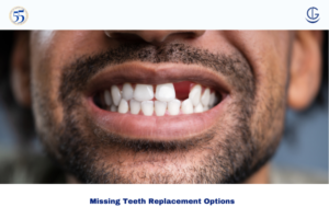 missing teeth replacement options