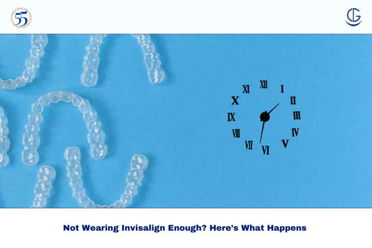 invisalign wear time