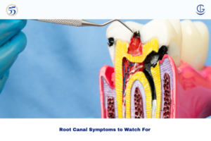 signs you need a root canal