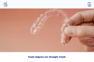 Teeth Aligners for Straight Teeth