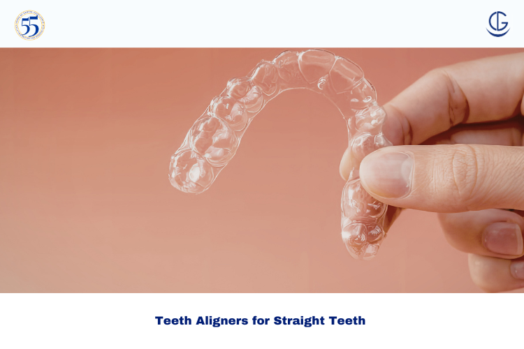 Teeth Aligners for Straight Teeth