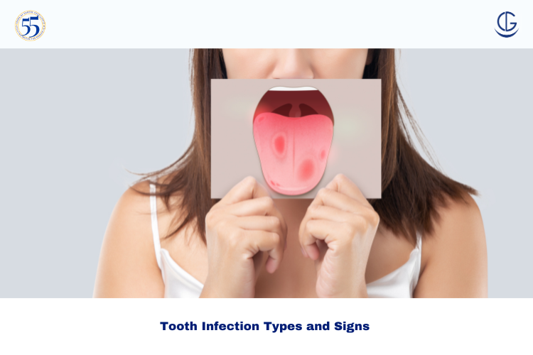 mouth infection