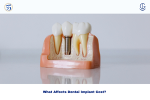 dental implant cost in hyderabad