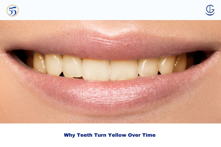 Yellow Teeth Causes
