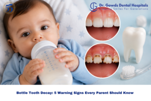 Bottle Tooth Decay