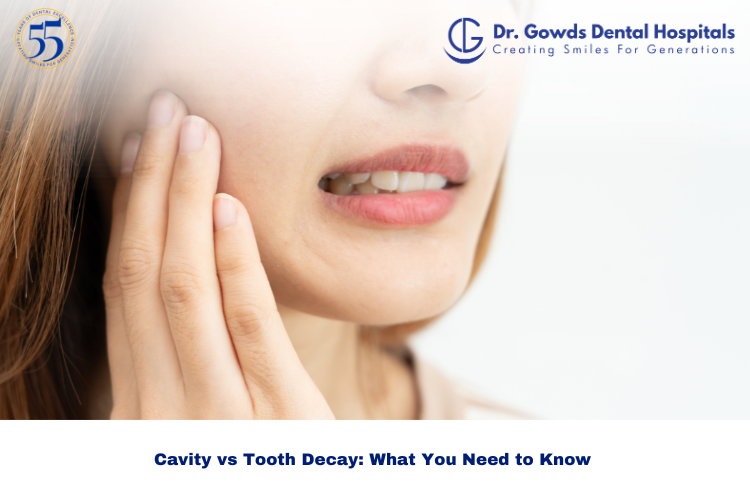 Tooth Decay vs Cavity