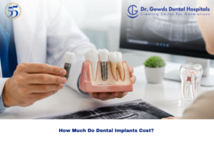 Tooth Implant Cost in India