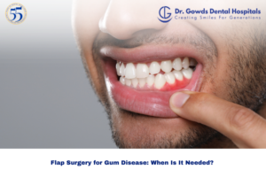 Flap Surgery for Gum Disease