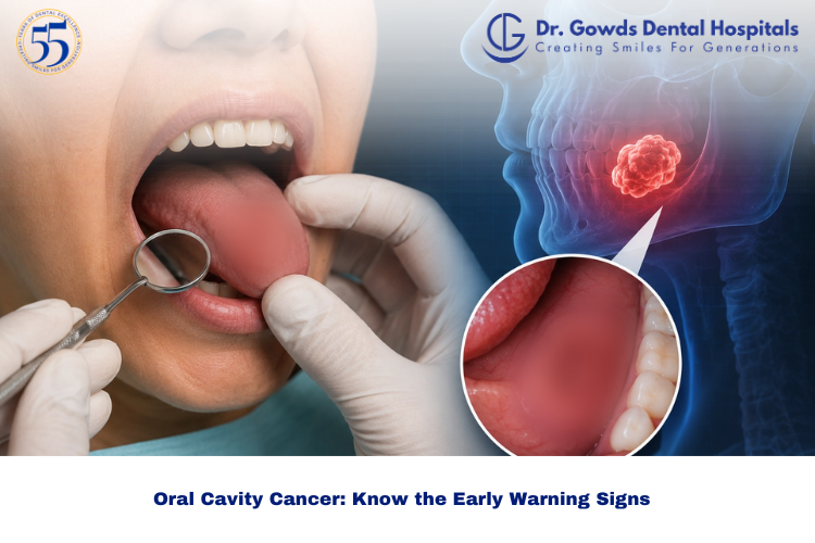 oral cavity cancer